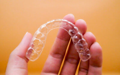 How Long Does It Take Invisalign to Close a Gap?