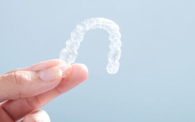 Top 6 Reasons Why You Need Clear Aligners