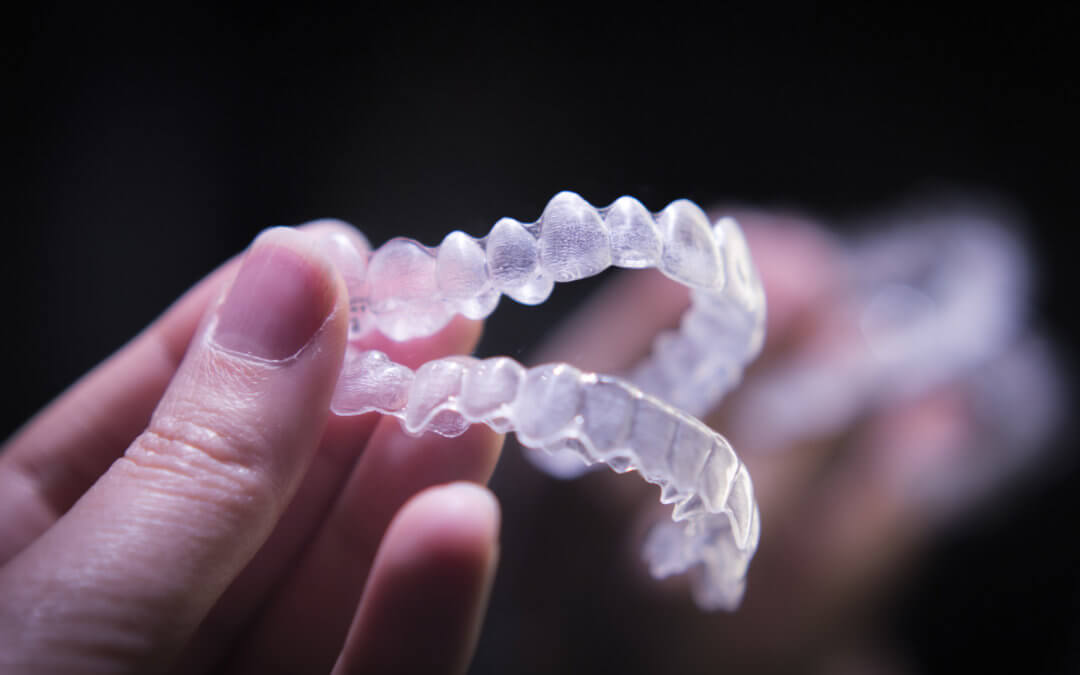 Here’s Something to Smile About!: 8 Fascinating Facts About Invisalign