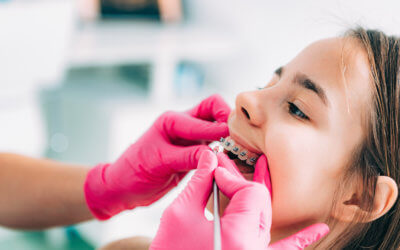 Family Orthodontics: 8 Tips for Choosing an Orthodontist
