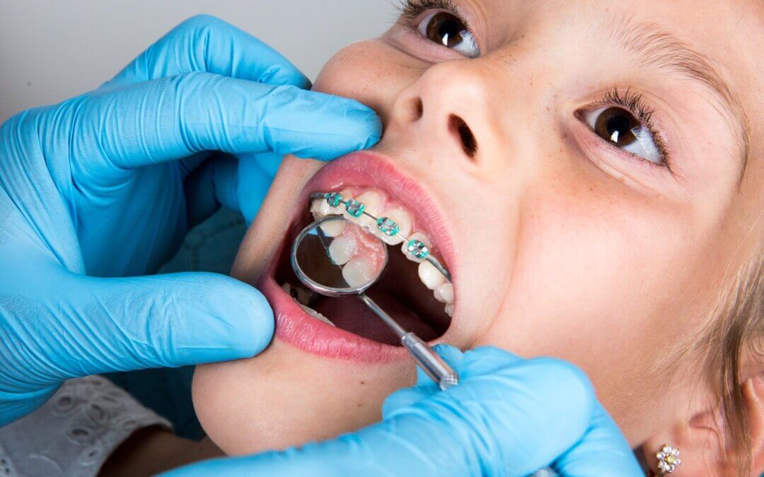 9 Benefits of Early Orthodontic Treatment for Your Children