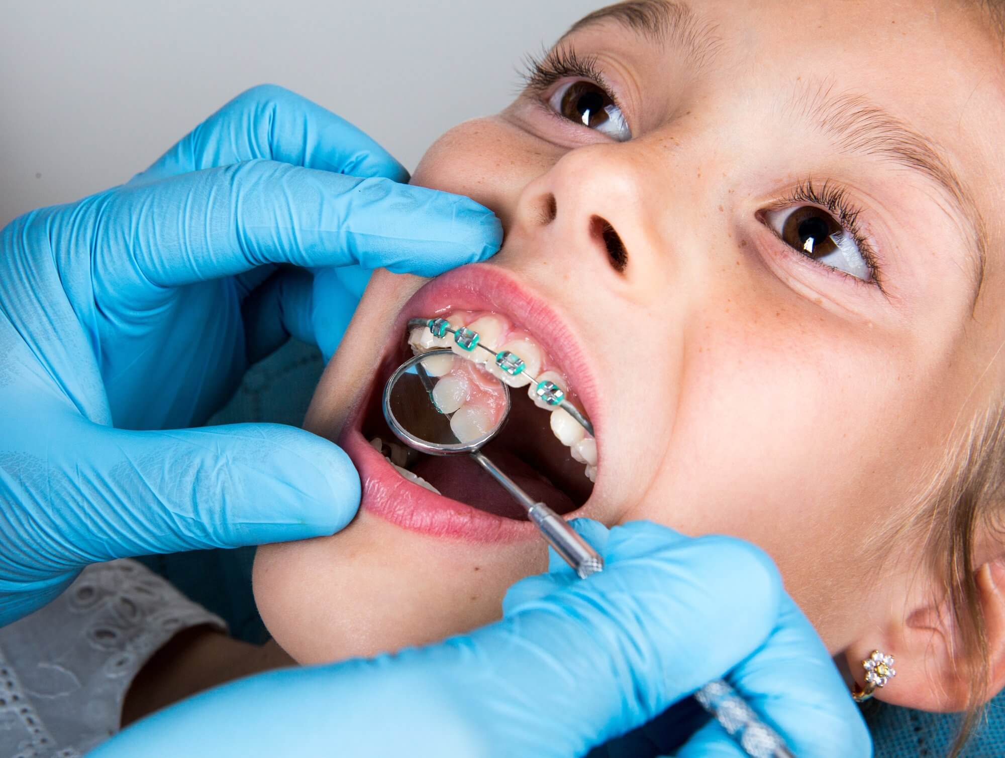 9 Benefits of Early Orthodontic Treatment for Your Children - Wardlaw ...