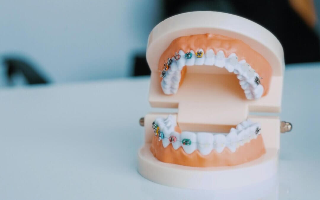 How Adult Orthodontic Treatments Improve Oral Health and Confidence